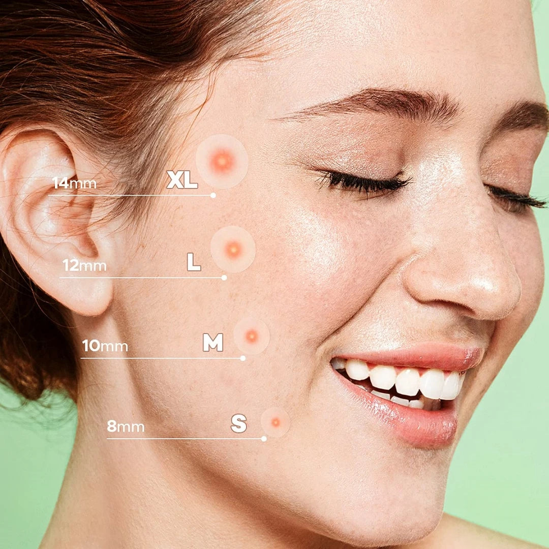 300/600-piece hydrogel acne patches containing salicylic acid, specially formulated for skincare.